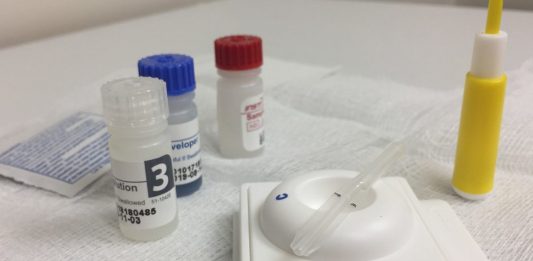Zestaw testowy stosowany do szybkiego wykrywania przeciwciał HIV w krwi.