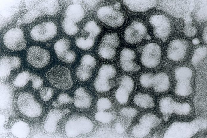Wirus grypy typu A, wywołujący ptasią grypę.