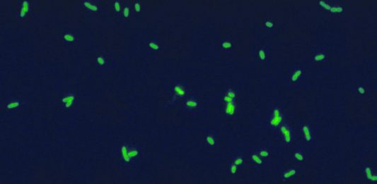 Fluoryzujące komórki bakterii Legionella.
