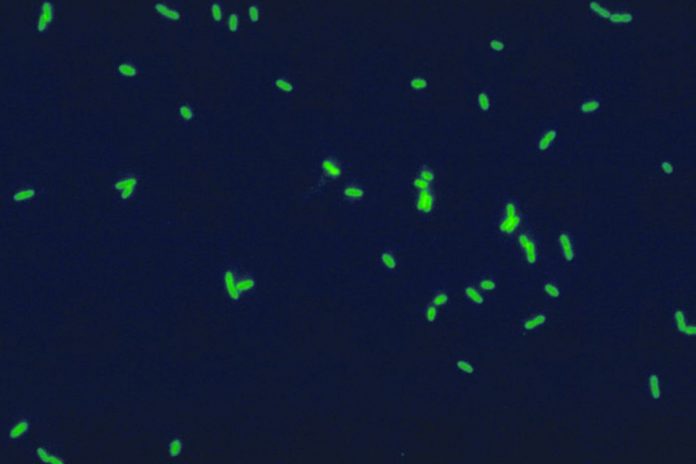 Fluoryzujące komórki bakterii Legionella.
